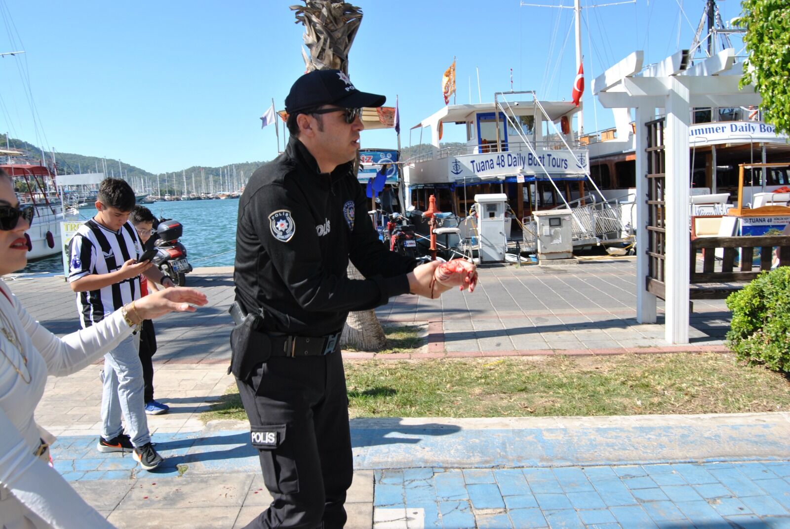 Kurt Köpeğinin Elinden Isırdığı Polis Hastaneye Kaldırıldı