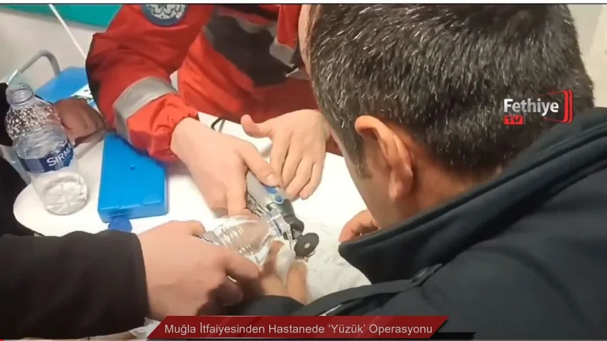 Muğla İtfaiyesinden Hastanede ‘Yüzük’ Operasyonu