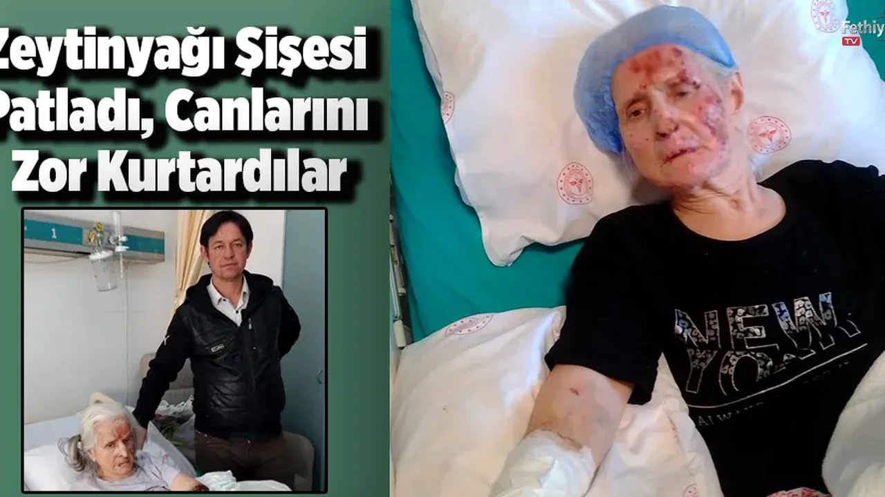 Zeytinyağı Şişesi Patladı, Canlarını Zor Kurtardılar