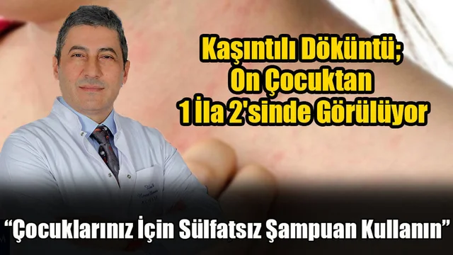 Kaşıntılı Döküntü; On Çocuktan 1 İla 2'sinde Görülüyor