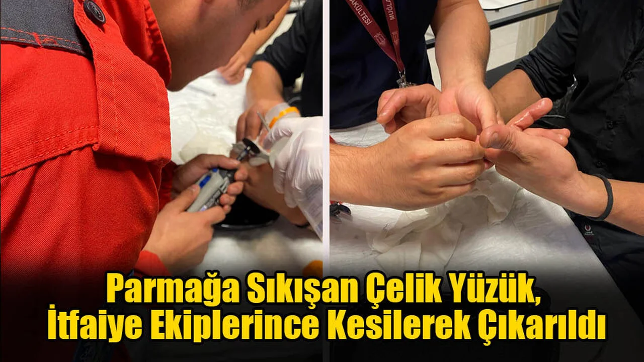 Parmağa Sıkışan Çelik Yüzük, İtfaiye Ekiplerince Kesilerek Çıkarıldı