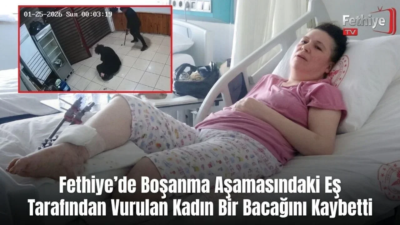 Fethiye’de Boşanma Aşamasındaki Eş Tarafından Vurulan Kadın Bir Bacağını Kaybetti