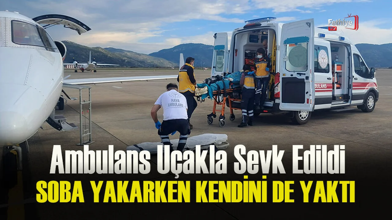 Soba Yakarken Kendini De Yaktı